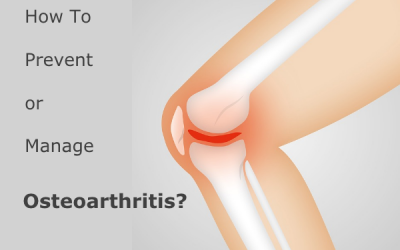 What Is Osteoarthritis? How To Prevent or Manage It?