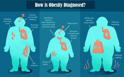 How is Obesity Diagnosed?
